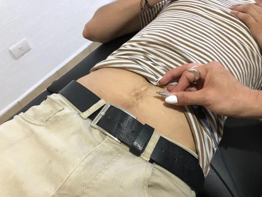 caboxiterapia tratamiento