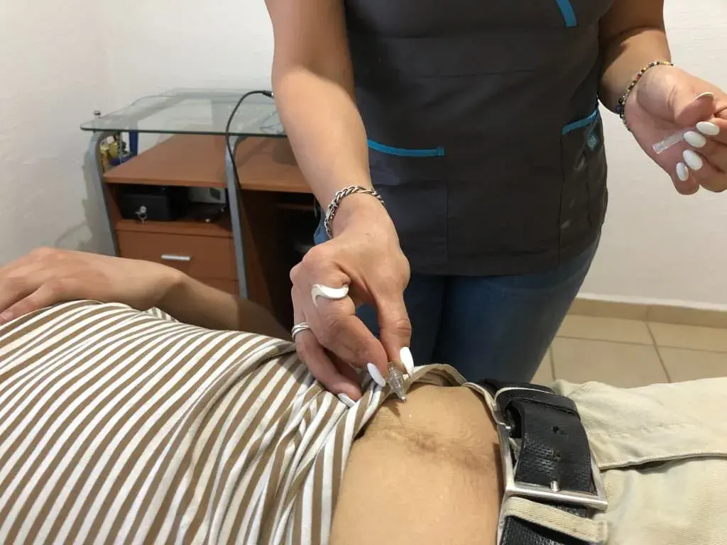 caboxiterapia tratamiento